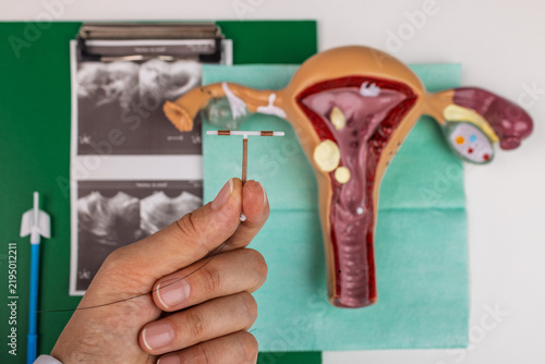 Cuadro en lienzo Hand holding copper intrauterine device before uterus model