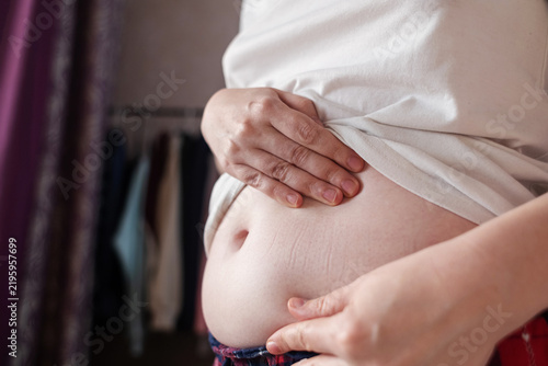 Photography Woman touching stretch marks on belly skin