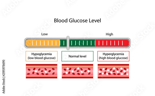 Blood Glucose Levels. Normal level, hypoglycemia (low blood sugar), hyperglycemia (high blood sugar), sugar test. Vector diagram.