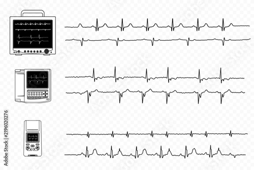 Vector illustrations of electrocardiogram devices with digital ECG traces on a transparent background. Vector illustrations of heart sound waves.