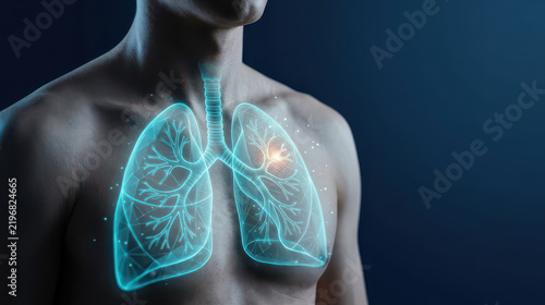 Radiant lung cancer illustration showing human chest with glowing airways and lung anatomy against dark background