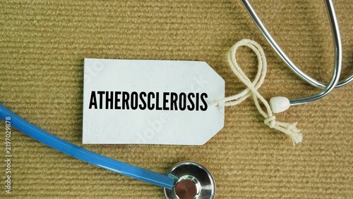 Konstfotografi Stethoscope and paper tag with word Atherosclerosis
