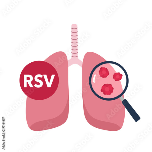 RSV disease infection concept vector illustration for medical and healthcare learning themes