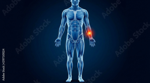 Human body anatomy showing pain in the wrist with a glowing red highlight on a blue medical background