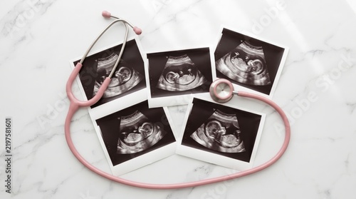 A woman looks at ultrasound pictures on a marble table while a stethoscope rests beside the images, showing developing baby stages in a bright and neat environment.