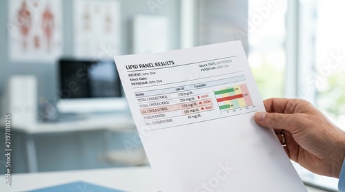 High cholesterol levels displayed on a man's lipid profile report from a medical laboratory test.