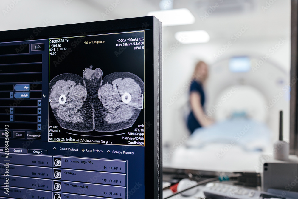 Obraz premium Close view of medical monitor displaying CT scan image with computed tomography scanner and healthcare worker blurred in background.