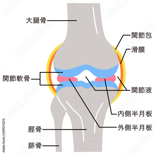 Naklejka 膝関節のしくみ 半月板 滑膜 変形性膝関節症
