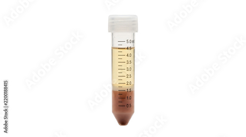 Obraz na płótnie Centrifuge tube with separated blood sample