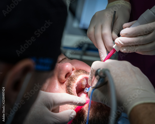 Dentist and assistant use a dental handpiece and suction while treating an adult male patient with an open mouth during a clinical procedure in a modern dental clinic.