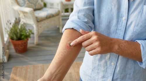 Woman applying a round medicated patch to her arm, close-up on skin with redness around the patch, indicating treatment or irritation. Outdoor porch setting.