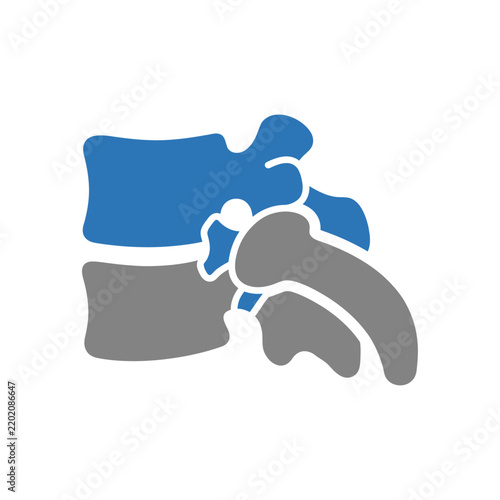 Spinal Disc Herniation Illustration: Lumbar Vertebrae and Intervertebral Disc