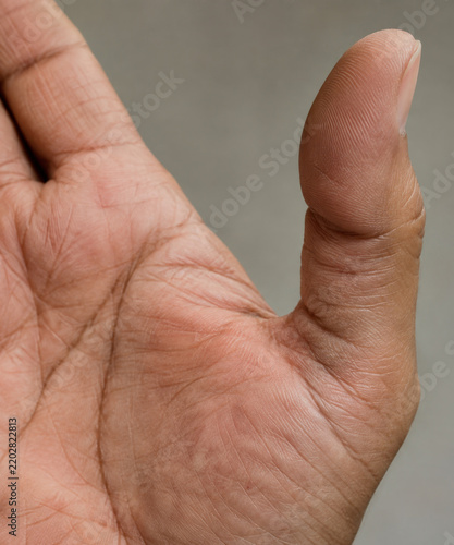 Close up human hand showing palm skin texture and raised thumb