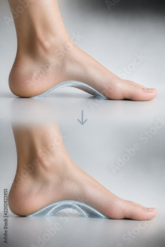 Foot arch support comparison shows improved alignment with transparent cushion