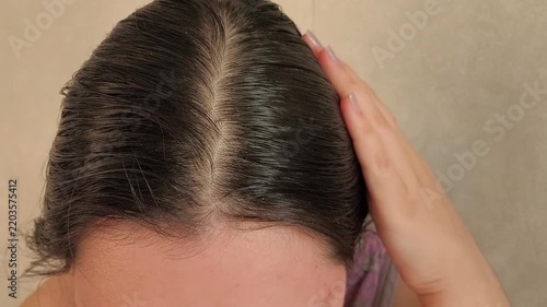a woman touching oily hair at the roots, representing greasy scalp, active sebaceous glands, excess sebum and scalp care.