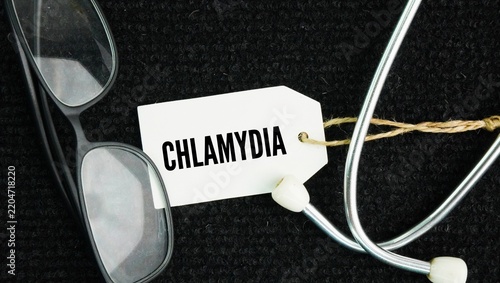Stethoscope and paper tag with the words Chlamydia is a common, curable sexually transmitted infection STI caused by the bacterium