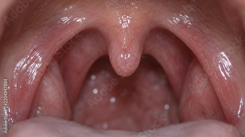 Human throat anatomy close up with uvula and tonsils inside open mouth