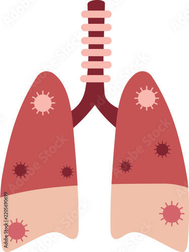 Pneumonia Illustration