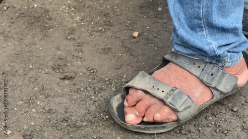 old man's toes are deformed due to an age-related illness.