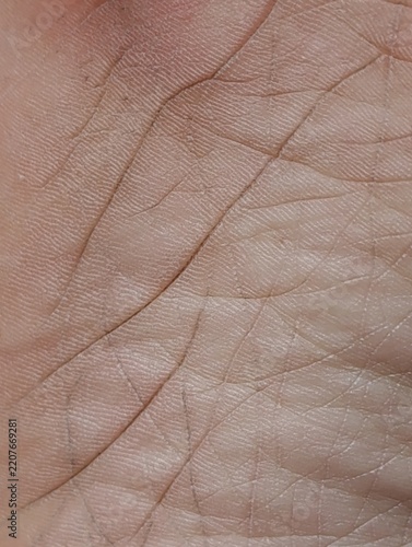 Close-up view of a human palm. Lines and creases are clearly visible.