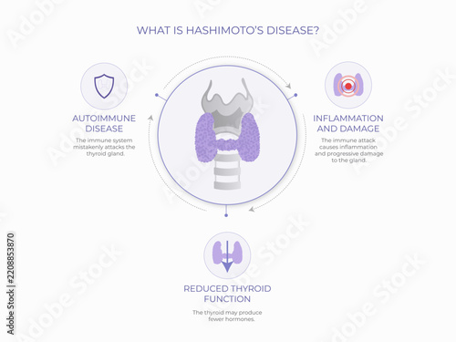 Symptoms of hashimotos disease common thyroid symptoms diagram showing common symptoms linked to hashimoto's thyroiditis affecting health