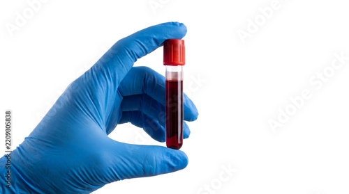 Laboratory hand holding blood vial on png background for clinical medical testing