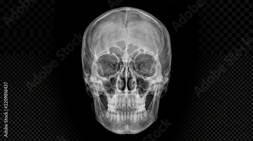X ray of a human skull frontal view isolated on black background medical imaging anatomy science