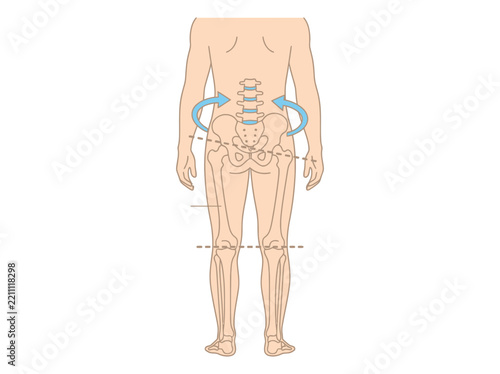 Pelvic Tilt and Posture Misalignment Anatomical Illustration Showing Leg Length Discrepancy and Spinal Imbalance