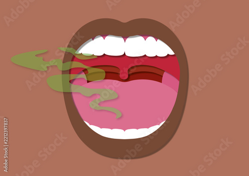 Bad breath, conceptual illustration