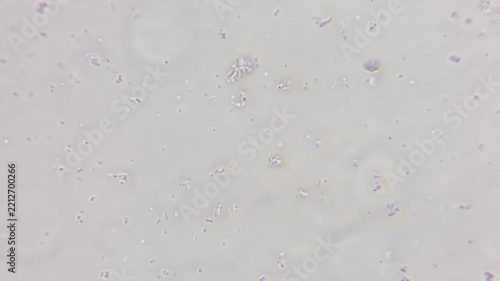 Microscopic view of bacteria causing sore throat and seasonal illness, medical microbiology lab research 