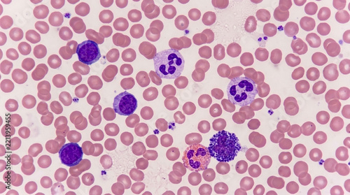 Microscopic view of human blood cells red blood cells and white blood cells leukocytes lymphocytes neutrophils eosinophils