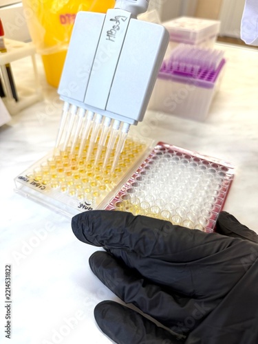 Fotografie Scientist performing ELISA test with multichannel pipette in lab