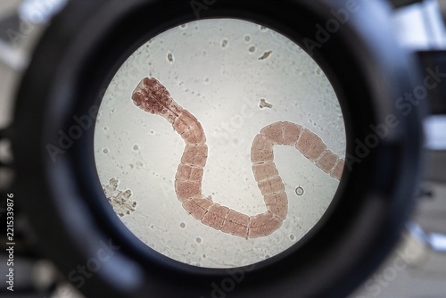 Microscopic view of a tapeworm parasite through a laboratory lens