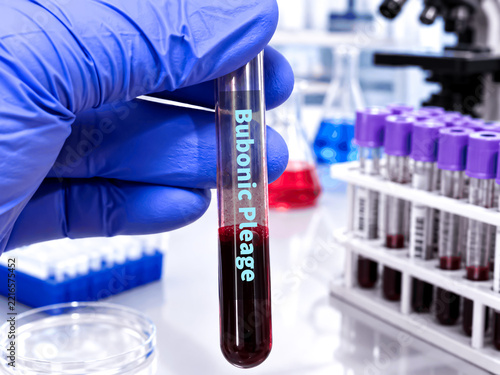 Blood sample for Bubonic plague (RT-PCR) test. It's one of three types of plague caused by the bacterium Yersinia pestis. 3D Illustrator