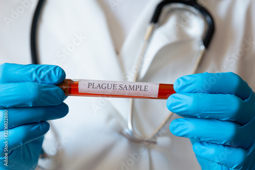pneumonic plague sample test tube doctor hands blue gloves medical uniform white coat lab background close up concept of healthcare, medicine, science