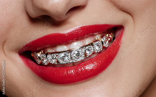 Close-up showcasing a woman with red lipstick, smiling brightly while revealing her diamond teeth grill. The sparkling accessory highlights her beauty and luxury style