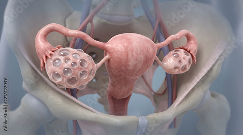 Medical 3D model of ovaries with multiple visible follicles arranged around the ovarian tissue, representing polycystic ovary syndrome, fertility issues, endocrinology, and gynecology.