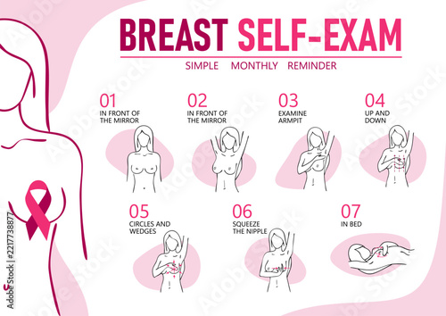 Breast cancer self-exam infographic showing prevention steps.