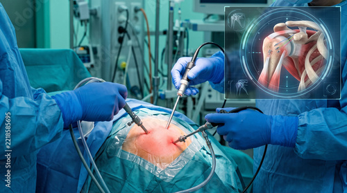 Surgeons hands performing arthroscopic shoulder surgery in operating theatre with red glow. CGI rotator cuff repair with suture anchors inset