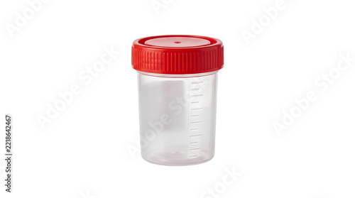 Plastic medical container with red lid for urine sample analysis