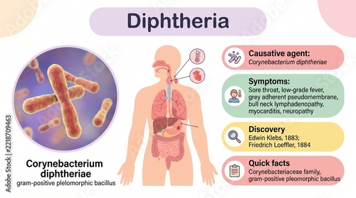 Diarrhea: Corynebacterium diphtheriae infection in the human body, colorful illustration showing bacteria inside digestive tract, pinkish-red streaks against internal organs, medical diagram style