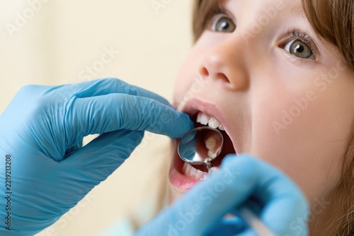 A close-up of a child undergoing a dental checkup with a dentist using a mirror and gloved hands to inspect the child's teeth.