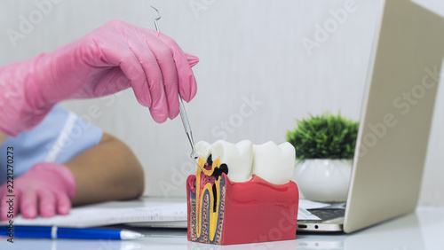 Dental professional explaining tooth decay and root canal anatomy using a colorful educational jaw model near a laptop in a modern medical office.