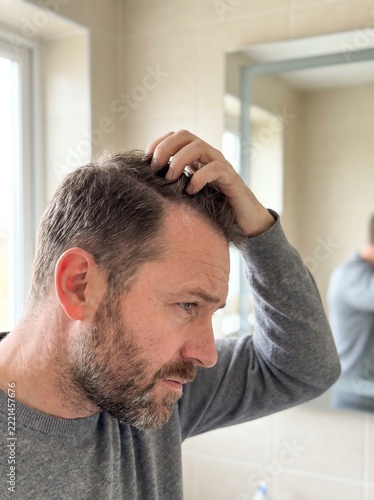 Man scratching dry scalp in bathroom mirror, feeling concerned about hair loss