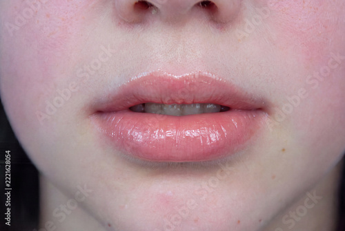 Close-up of natural pink lips with a glossy finish and slightly parted mouth. Detailed view of the lips, surrounding facial skin, and natural skin texture in soft lighting. Minimal makeup and realisti