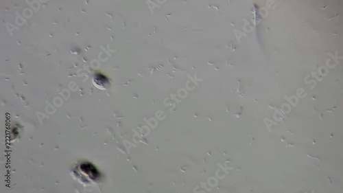 Microscopic view of bacteria and microorganisms swimming in pond water, spirillum and bacilli, 600x magnification
