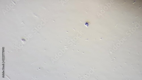 Microscopic view of bacteria and microorganisms swimming in pond water, spirillum and bacilli, 600x magnification