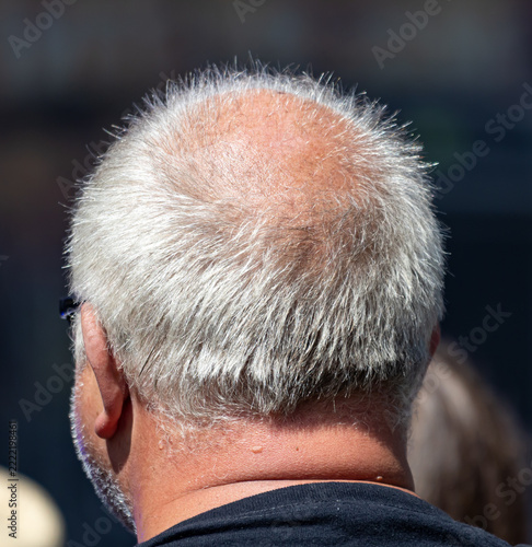 Back view of a man with thinning gray hair