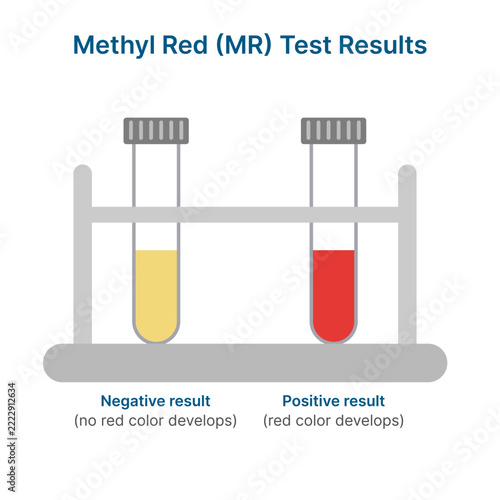 Methyl Red MR Test Results Diagram Showing Yellow Negative and Red Positive Tubes