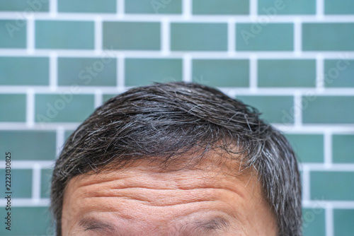 Close-up of deep wrinkles on a man's forehead against background of green tiles.
